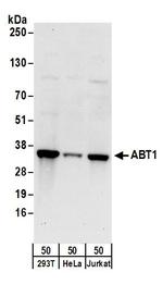 ABT1 Polyclonal Antibody