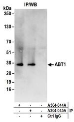 ABT1 Antibody in Immunoprecipitation (IP)