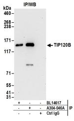 TIP120B Antibody in Immunoprecipitation (IP)