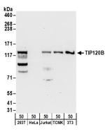 TIP120B Polyclonal Antibody