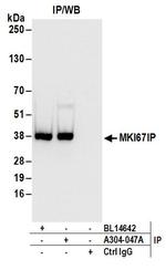 MKI67IP Antibody in Immunoprecipitation (IP)