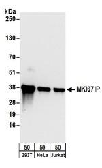 MKI67IP Polyclonal Antibody