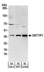 DNTTIP1 Antibody in Western Blot (WB)