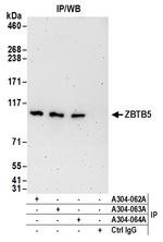 ZBTB5 Antibody in Immunoprecipitation (IP)