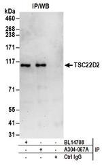 TSC22D2 Polyclonal Antibody