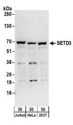 SETD3 Polyclonal Antibody