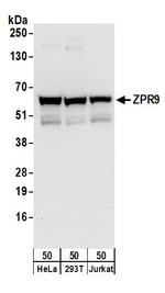 ZPR9 Antibody in Western Blot (WB)