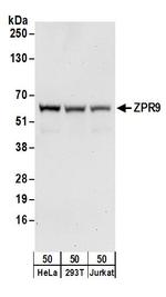 ZPR9 Polyclonal Antibody