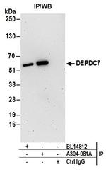 DEPDC7 Antibody in Immunoprecipitation (IP)