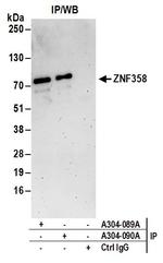 ZNF358 Polyclonal Antibody