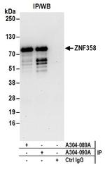 ZNF358 Antibody in Immunoprecipitation (IP)