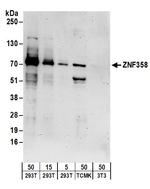 ZNF358 Antibody in Western Blot (WB)