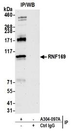 RNF169 Polyclonal Antibody