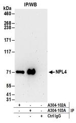 NPL4 Polyclonal Antibody