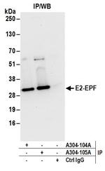 E2-EPF Polyclonal Antibody