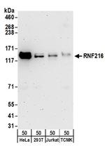 RNF216 Polyclonal Antibody