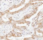 UBAC1 Polyclonal Antibody