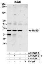MMS21 Antibody in Immunoprecipitation (IP)