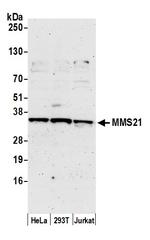 MMS21 Polyclonal Antibody