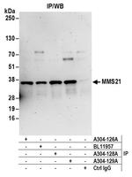 MMS21 Polyclonal Antibody