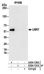 UBR7 Antibody in Immunoprecipitation (IP)