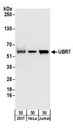 UBR7 Polyclonal Antibody