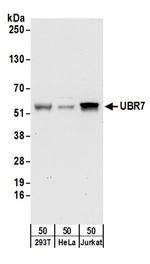 UBR7 Antibody in Western Blot (WB)