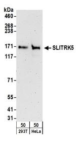 SLITRK5 Polyclonal Antibody