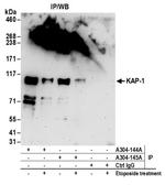 KAP-1 Antibody in Immunoprecipitation (IP)