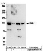 KAP-1 Antibody in Western Blot (WB)