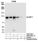 KAP-1 Antibody in Immunoprecipitation (IP)