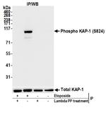 Phospho-KAP-1 (Ser824) Antibody in Immunoprecipitation (IP)