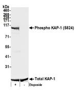 Phospho-KAP-1 (Ser824) Polyclonal Antibody