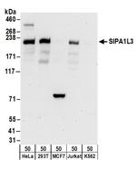 SIPA1L3 Polyclonal Antibody