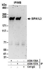 SIPA1L3 Polyclonal Antibody