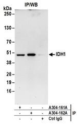 IDH1 Antibody in Immunoprecipitation (IP)