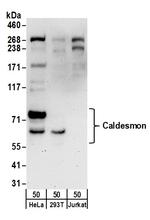 Caldesmon Antibody in Western Blot (WB)