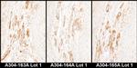 Caldesmon Antibody in Immunohistochemistry (Paraffin) (IHC (P))