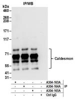 Caldesmon Antibody in Immunoprecipitation (IP)