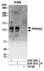 PPIP5K2 Polyclonal Antibody