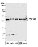 PPIP5K2 Polyclonal Antibody