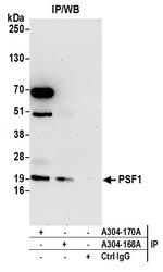 PSF1 Polyclonal Antibody