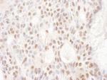 CDKL5 Polyclonal Antibody