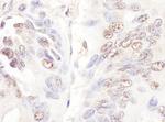 CDKL5 Antibody in Immunohistochemistry (Paraffin) (IHC (P))