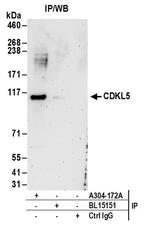CDKL5 Antibody in Immunoprecipitation (IP)