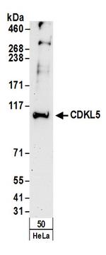 CDKL5 Antibody in Western Blot (WB)