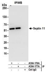 Septin 11 Antibody in Immunoprecipitation (IP)