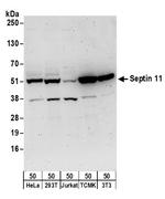 Septin 11 Polyclonal Antibody