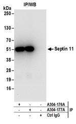 Septin 11 Antibody in Immunoprecipitation (IP)