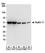 Septin 11 Polyclonal Antibody